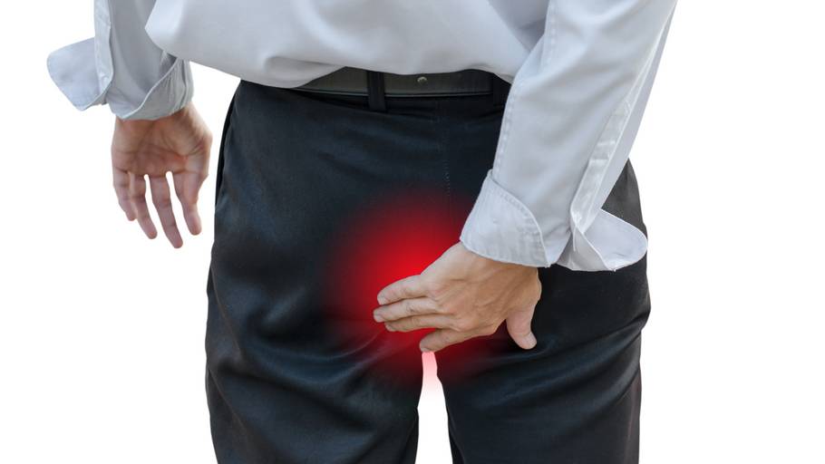 Hämorrhoiden Hämorrhoiden
